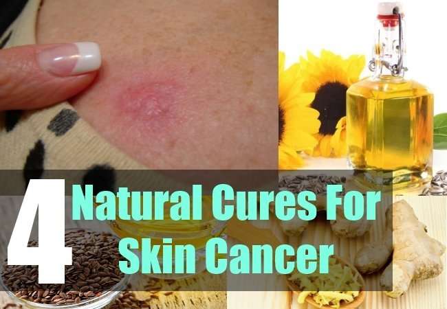 4 Natural Cures for Skin Cancer