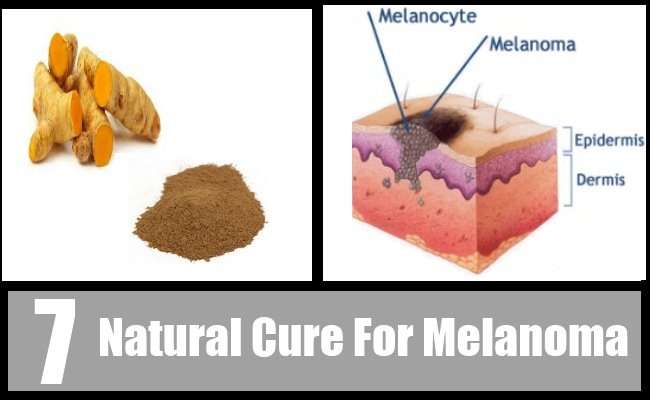 7 Natural Cure For Melanoma