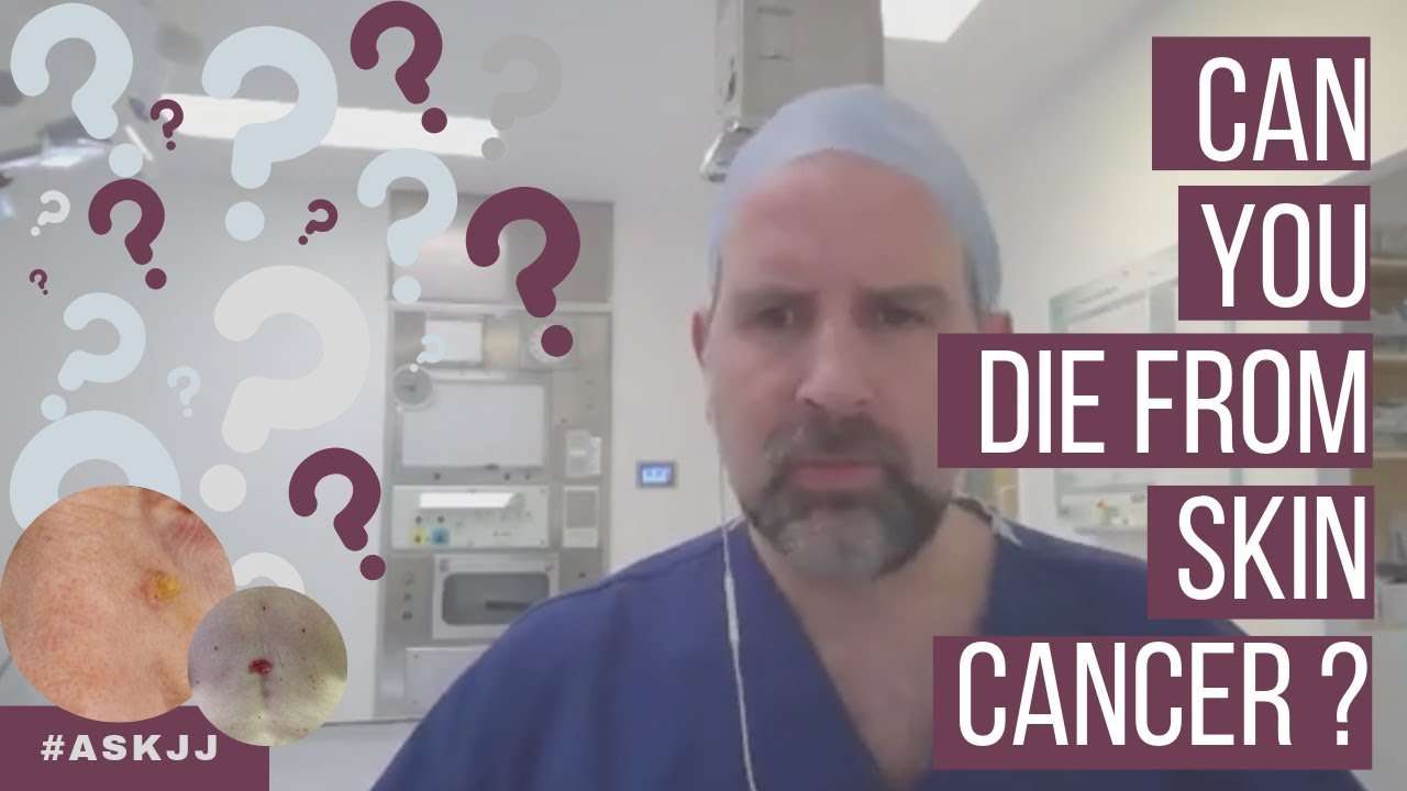 Can you die from Skin Cancer?