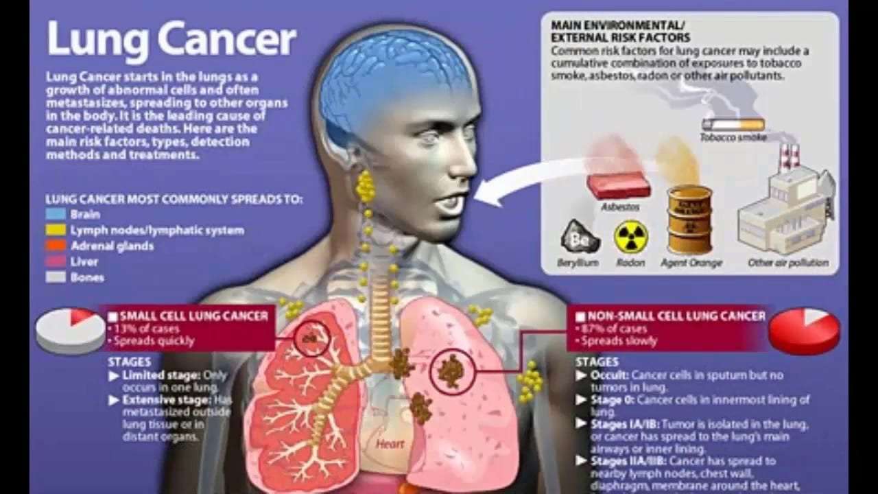 Cancer &  Nicotine: Is there any relation?