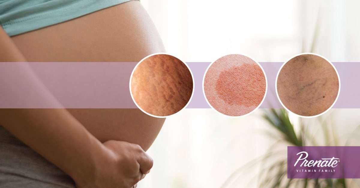 Changes to Skin During Pregnancy