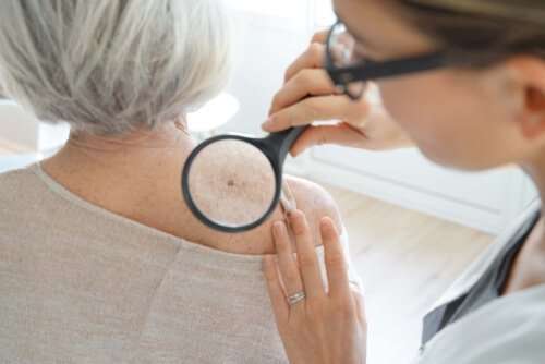 Does Medicare Cover Dermatologist Visits in 2020? Learn More