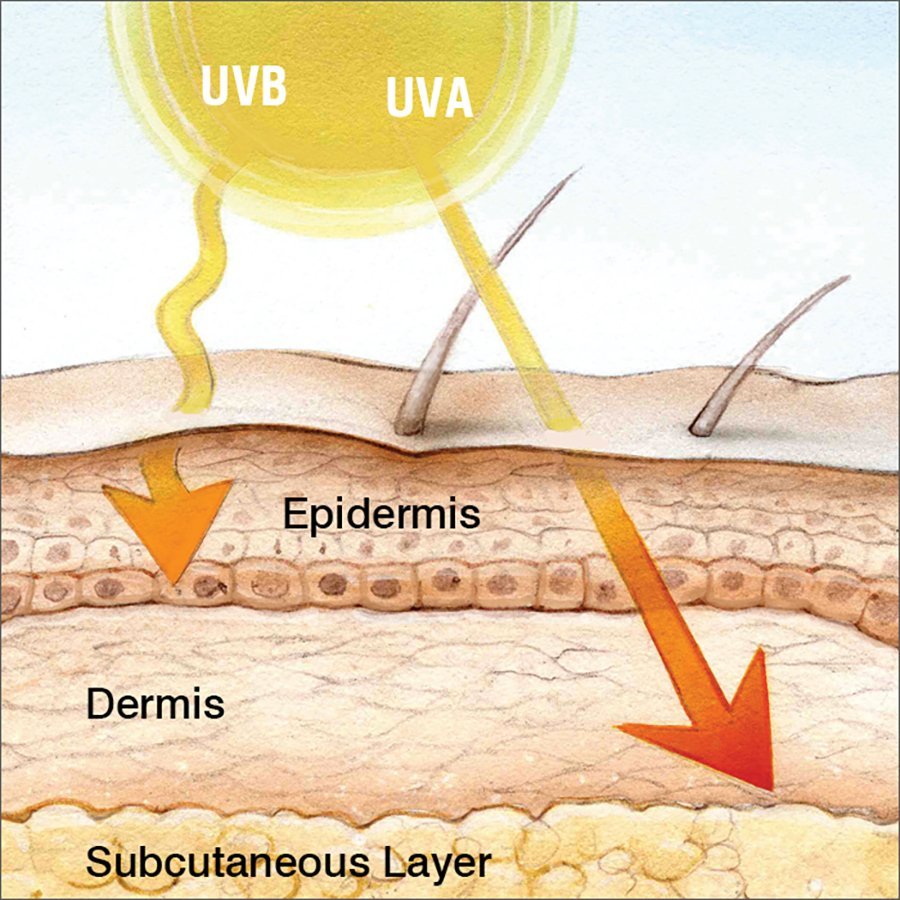 Does UV radiation cause cancer?