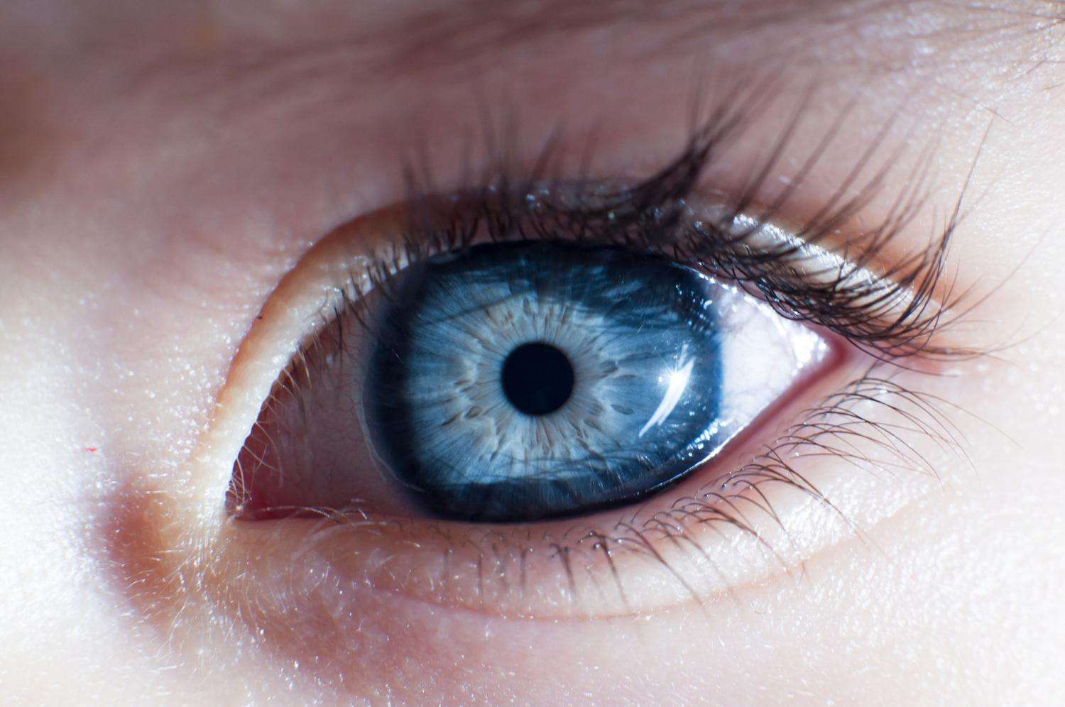 Eye melanoma, media hype, and genomic medicine