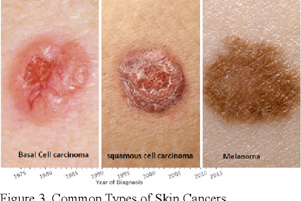 Figure 3 from Skin Cancer Concerns in People of Color ...