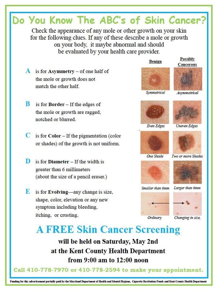 Free Skin Cancer Screening May 2
