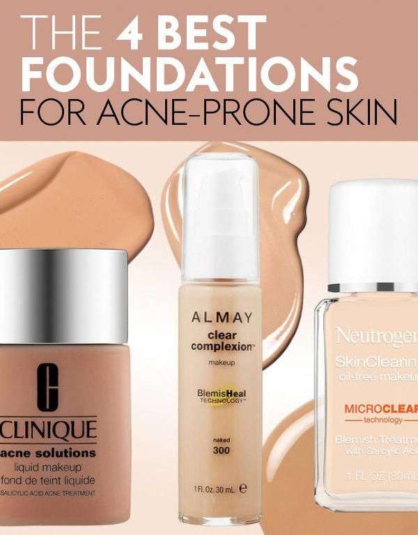 Have oily, acne