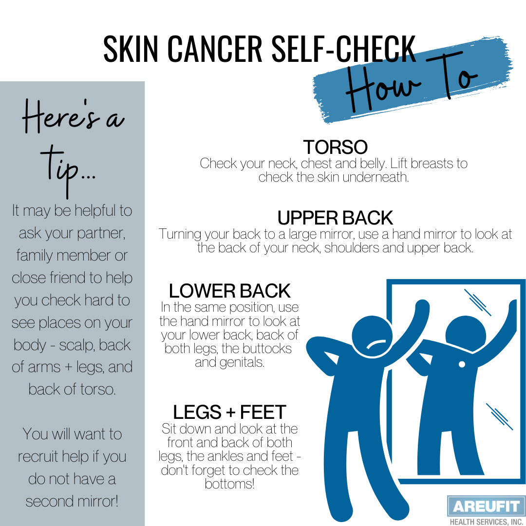 How to check yourself for skin cancer