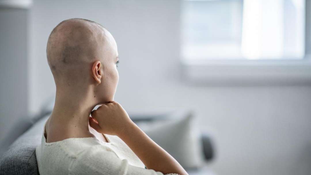 New cancer treatment prevents hair loss from chemotherapy ...
