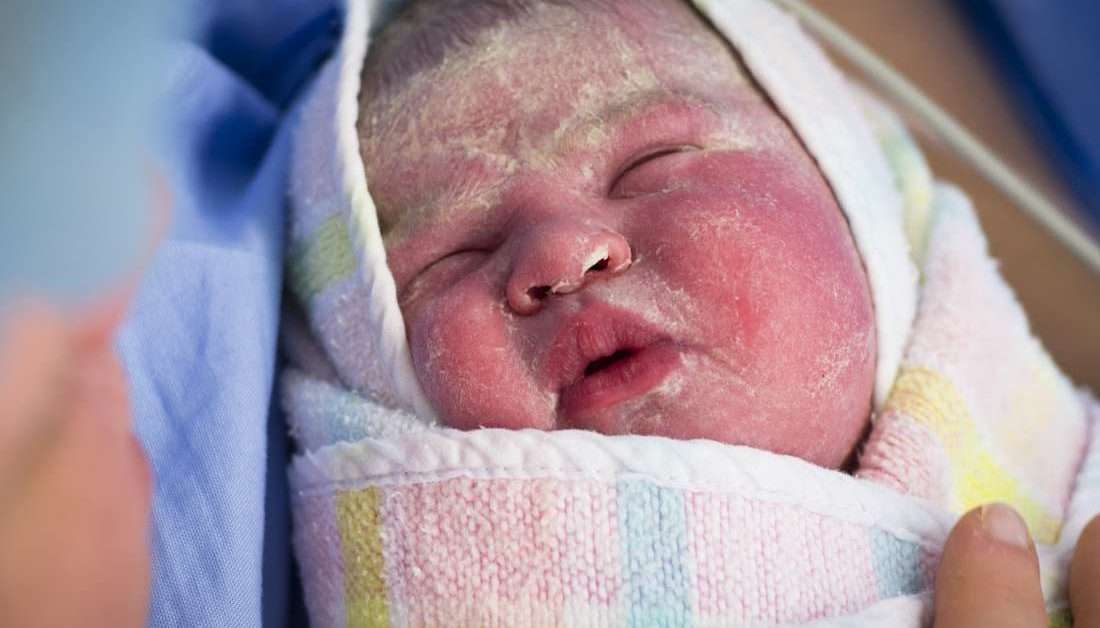 Newborn skin peeling: Causes, treatment, and home remedies