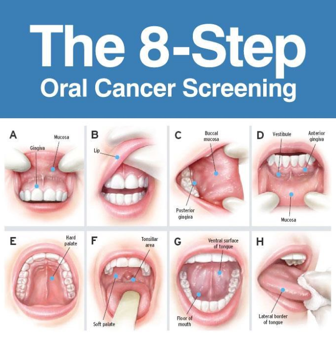Oral Cancer Awareness  Early Detection is Key