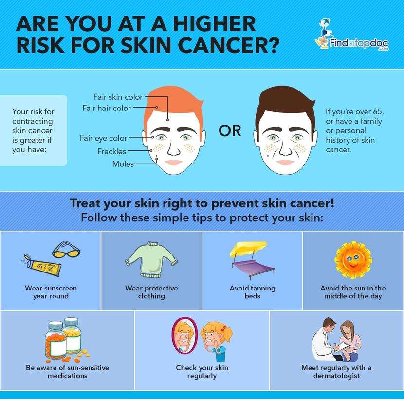 Skin Cancer: Symptoms, Causes, Treatment, and Diagnosis ...