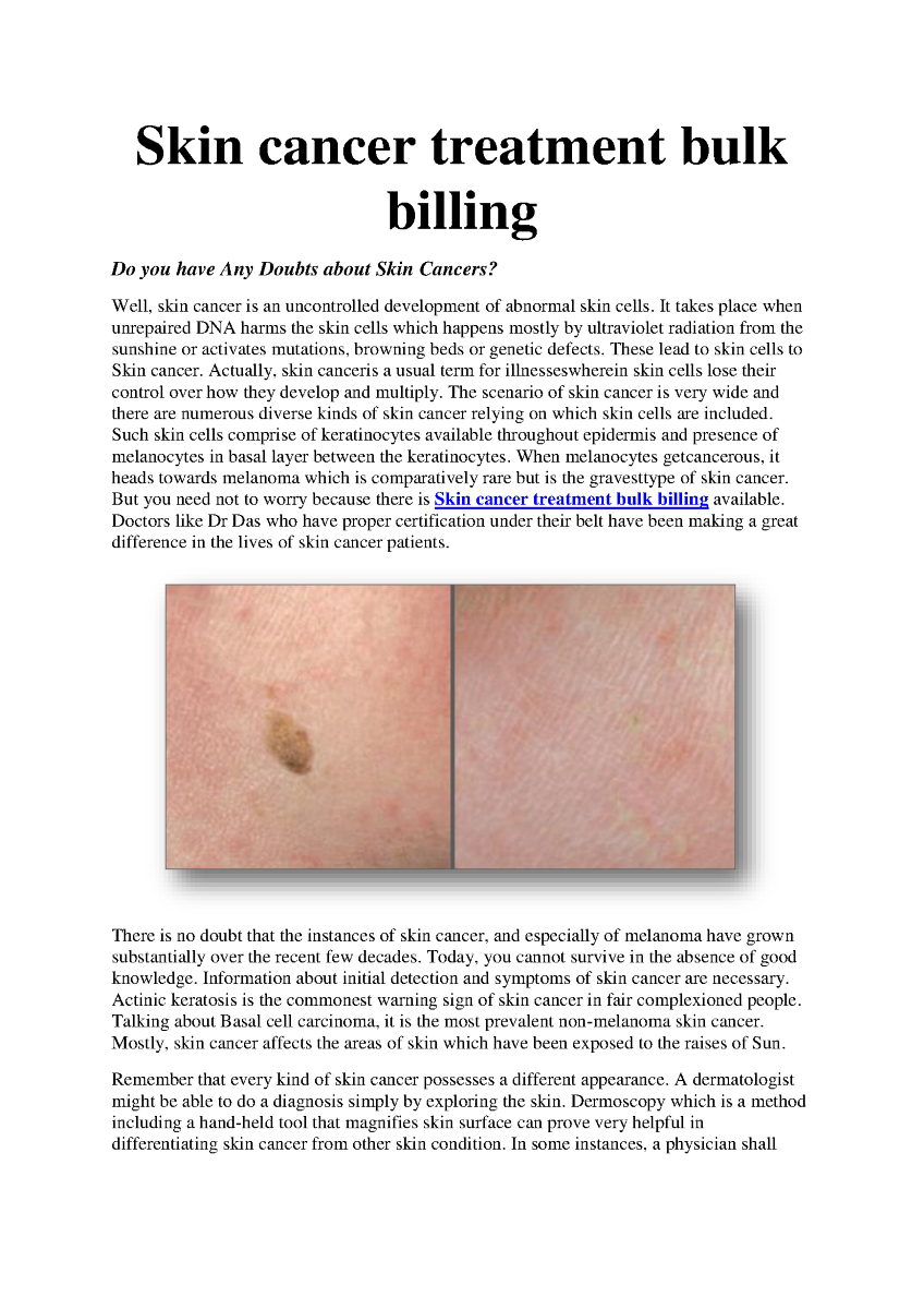 Skin Cancer Treatment Bulk Billing