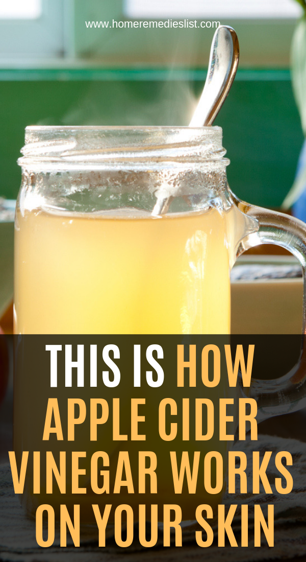 This Is How Apple Cider Vinegar Works On Your Skin ...