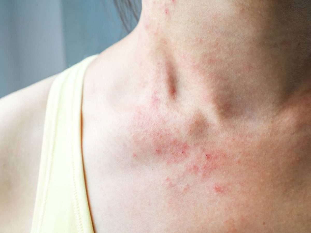 Tiny Red Spots On Skin: Bumps, Itchy, Non Itchy, Causes, Get Rid, Treatment