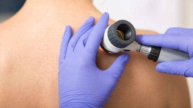 What Happens During a Skin Cancer Screening ...