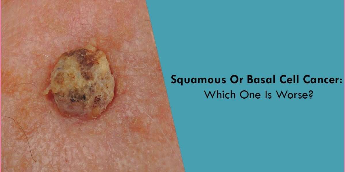 Which Is Worse Squamous Or Basal Cell Carcinoma ...