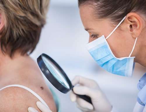 Why You Need an Annual Skin Cancer Screening